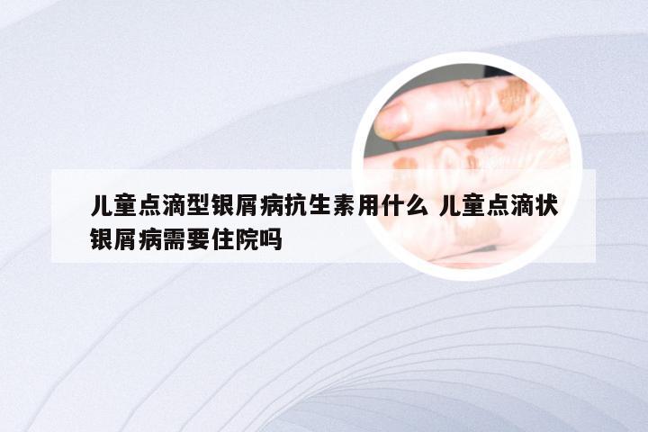 儿童点滴型银屑病抗生素用什么 儿童点滴状银屑病需要住院吗