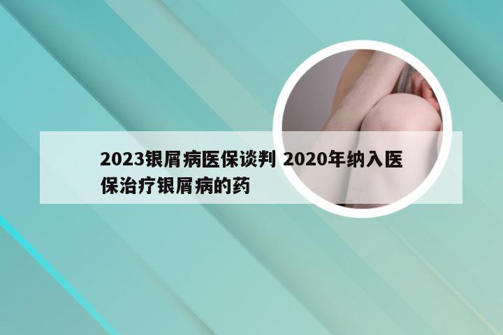 2023银屑病医保谈判 2020年纳入医保治疗银屑病的药