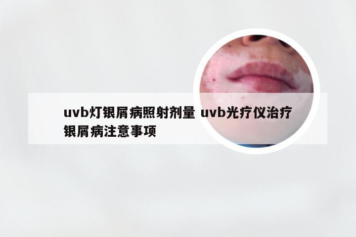 uvb灯银屑病照射剂量 uvb光疗仪治疗银屑病注意事项