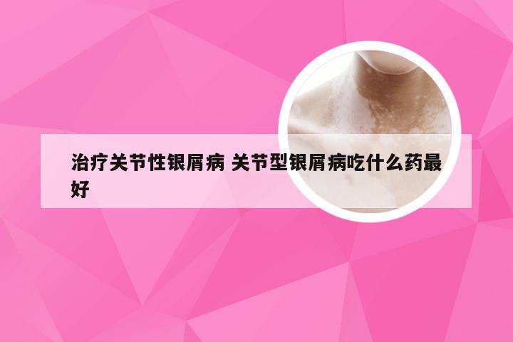 治疗关节性银屑病 关节型银屑病吃什么药最好