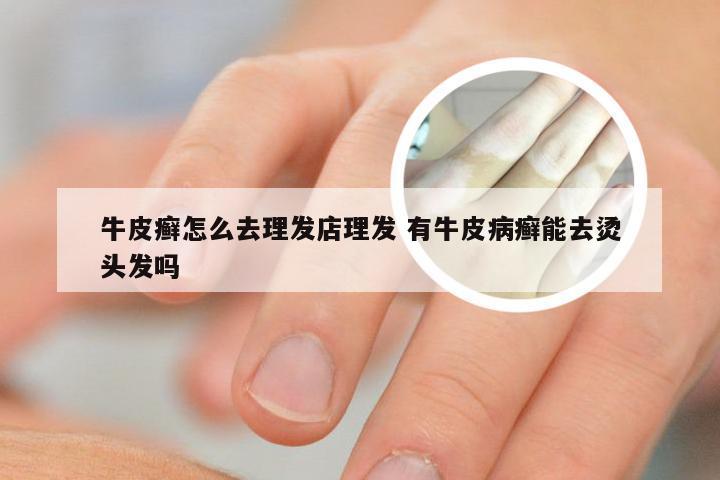 牛皮癣怎么去理发店理发 有牛皮病癣能去烫头发吗