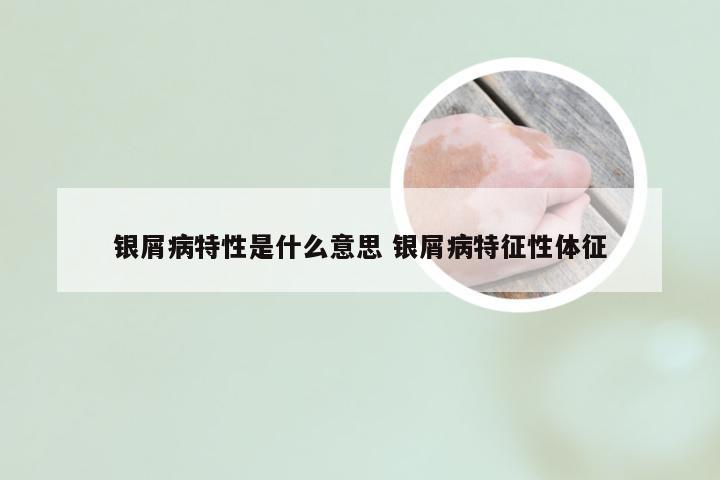 银屑病特性是什么意思 银屑病特征性体征