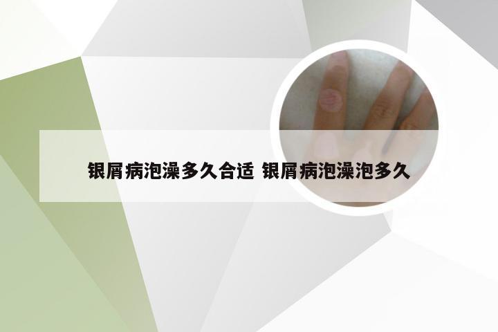 银屑病泡澡多久合适 银屑病泡澡泡多久