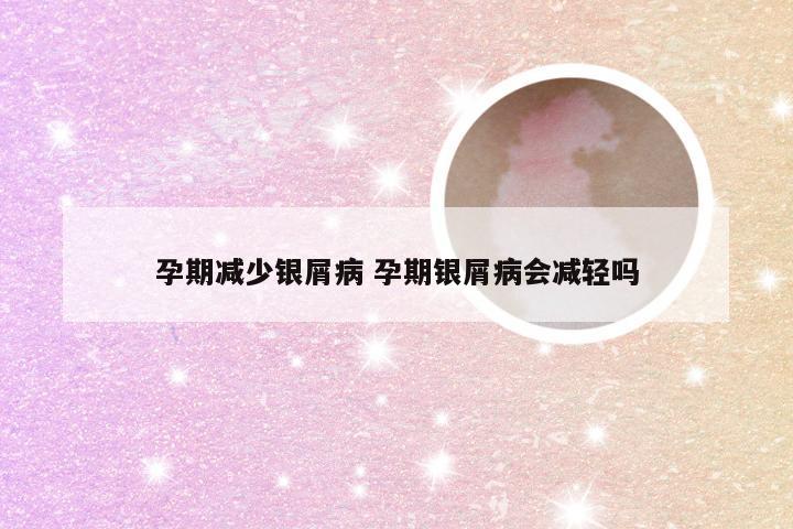 孕期减少银屑病 孕期银屑病会减轻吗