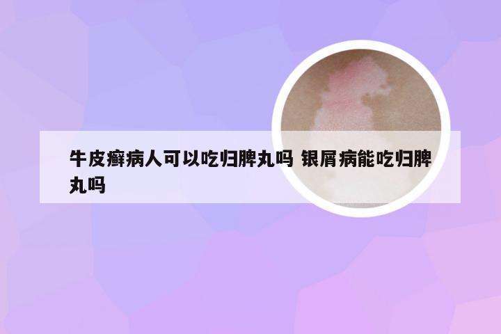 牛皮癣病人可以吃归脾丸吗 银屑病能吃归脾丸吗