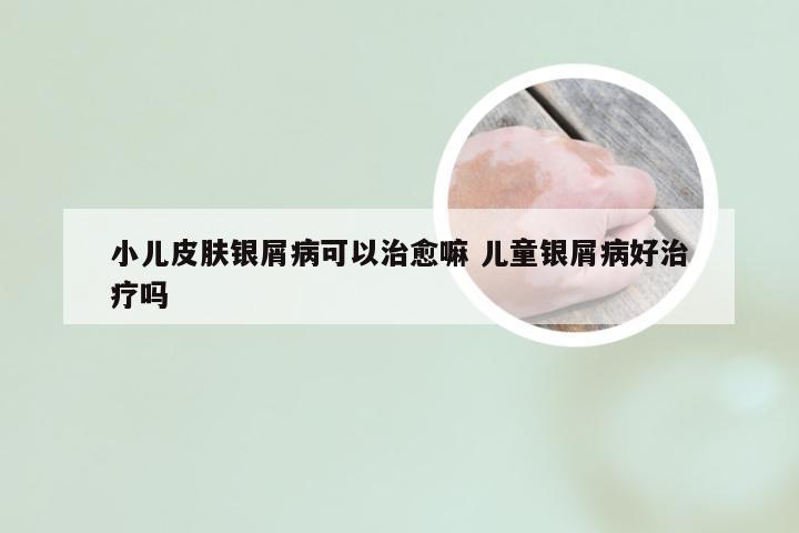 小儿皮肤银屑病可以治愈嘛 儿童银屑病好治疗吗