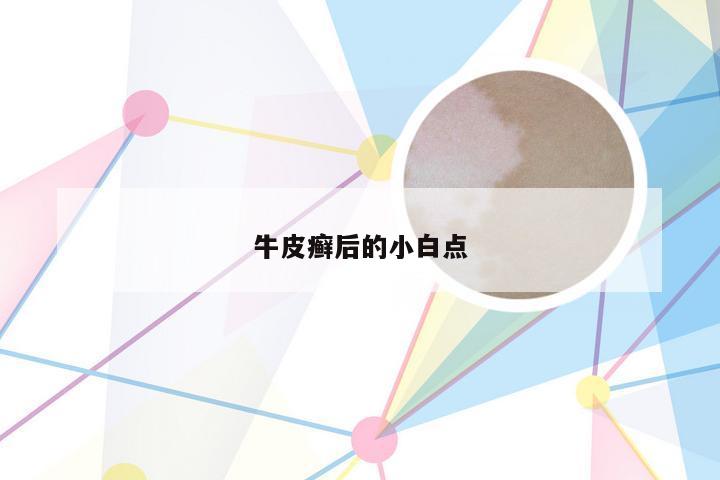 牛皮癣后的小白点