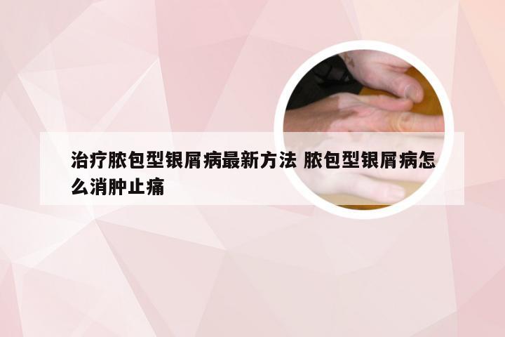 治疗脓包型银屑病最新方法 脓包型银屑病怎么消肿止痛