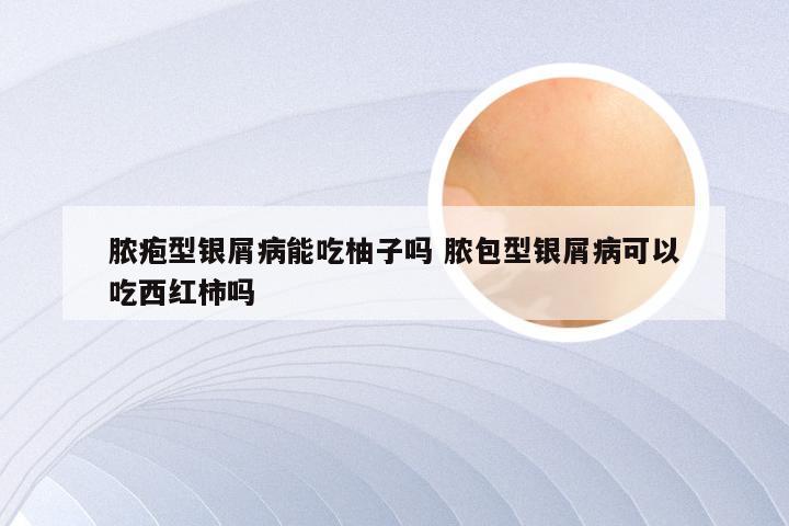 脓疱型银屑病能吃柚子吗 脓包型银屑病可以吃西红柿吗