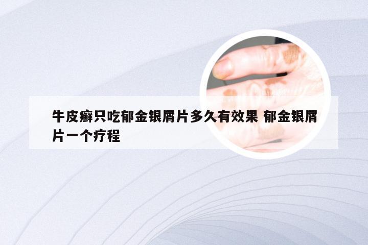 牛皮癣只吃郁金银屑片多久有效果 郁金银屑片一个疗程