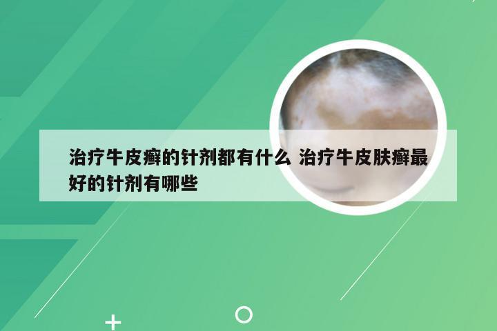 治疗牛皮癣的针剂都有什么 治疗牛皮肤癣最好的针剂有哪些