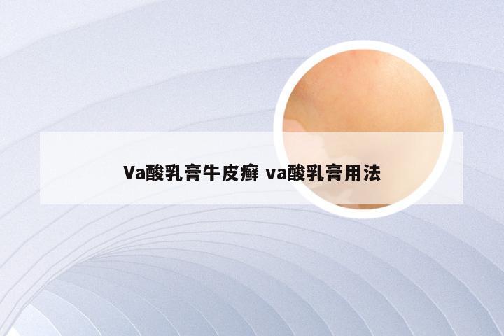 Va酸乳膏牛皮癣 va酸乳膏用法