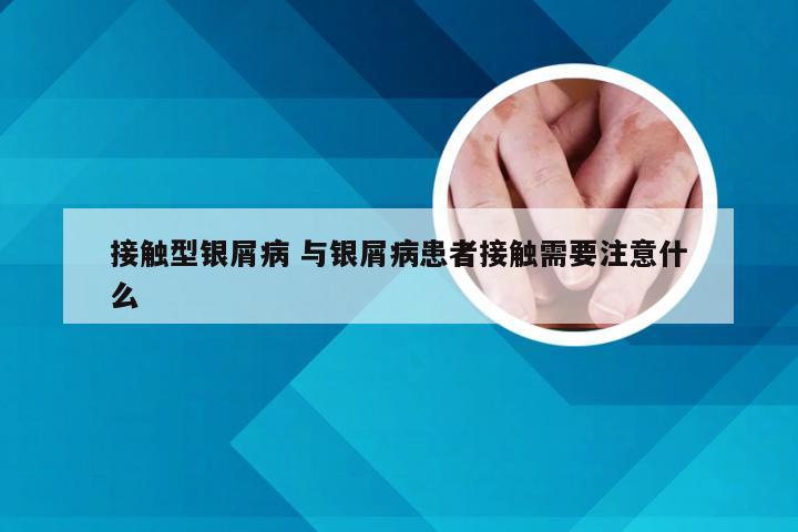 接触型银屑病 与银屑病患者接触需要注意什么