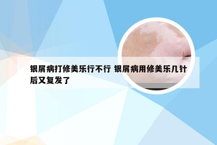 银屑病打修美乐行不行 银屑病用修美乐几针后又复发了