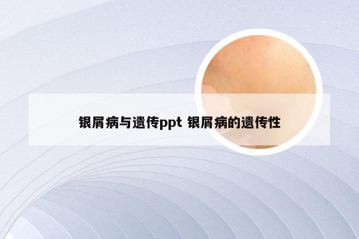 银屑病与遗传ppt 银屑病的遗传性