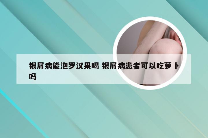 银屑病能泡罗汉果喝 银屑病患者可以吃萝卜吗