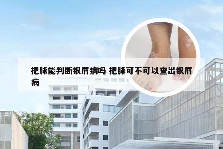 把脉能判断银屑病吗 把脉可不可以查出银屑病