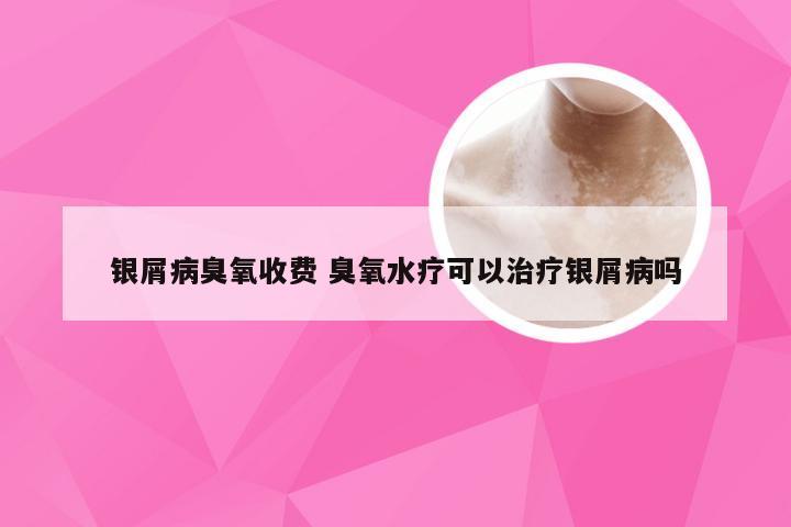 银屑病臭氧收费 臭氧水疗可以治疗银屑病吗