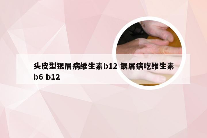 头皮型银屑病维生素b12 银屑病吃维生素b6 b12