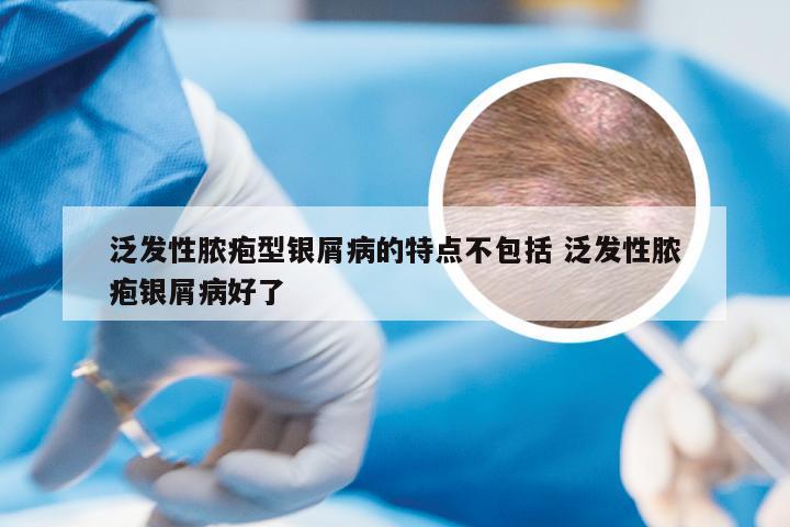 泛发性脓疱型银屑病的特点不包括 泛发性脓疱银屑病好了