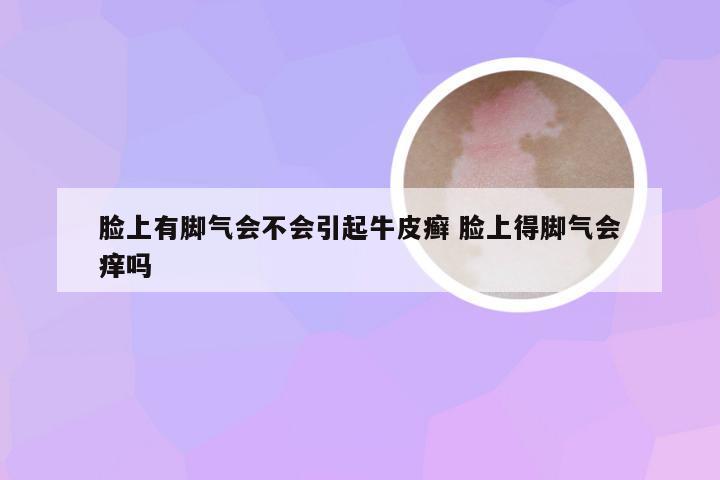 脸上有脚气会不会引起牛皮癣 脸上得脚气会痒吗