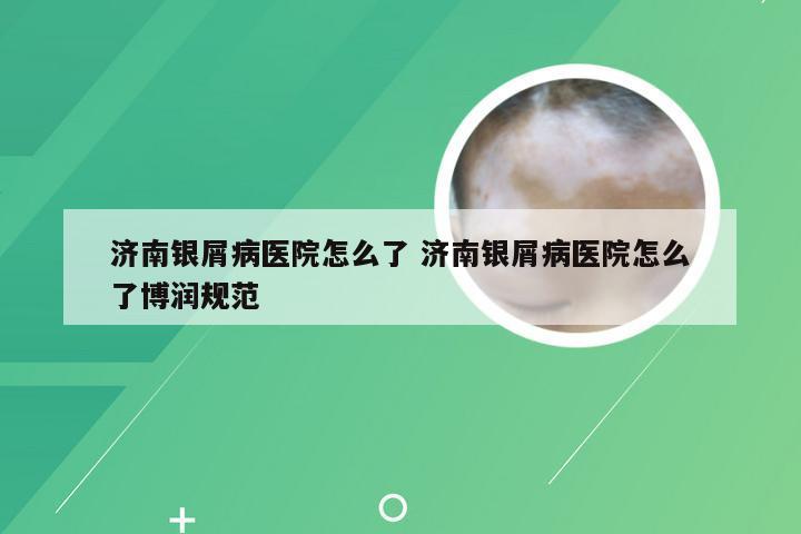 济南银屑病医院怎么了 济南银屑病医院怎么了博润规范