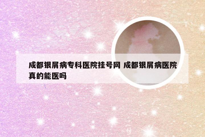 成都银屑病专科医院挂号网 成都银屑病医院真的能医吗