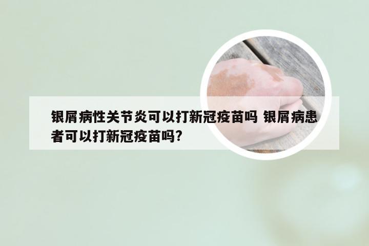 银屑病性关节炎可以打新冠疫苗吗 银屑病患者可以打新冠疫苗吗?