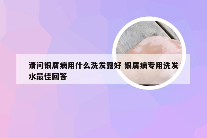 请问银屑病用什么洗发露好 银屑病专用洗发水最佳回答