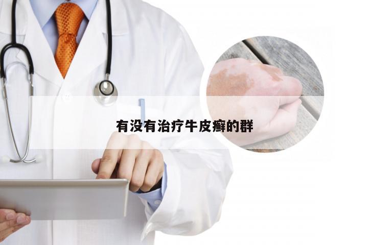 有没有治疗牛皮癣的群