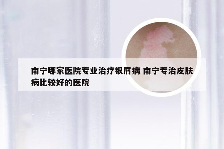 南宁哪家医院专业治疗银屑病 南宁专治皮肤病比较好的医院