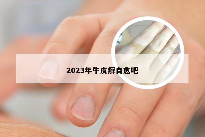 2023年牛皮癣自愈吧