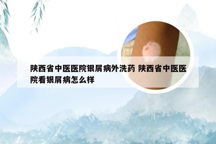 陕西省中医医院银屑病外洗药 陕西省中医医院看银屑病怎么样