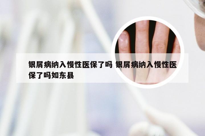 银屑病纳入慢性医保了吗 银屑病纳入慢性医保了吗如东县