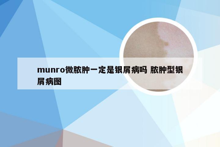 munro微脓肿一定是银屑病吗 脓肿型银屑病图