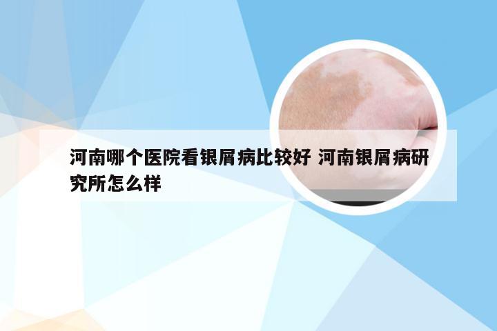 河南哪个医院看银屑病比较好 河南银屑病研究所怎么样