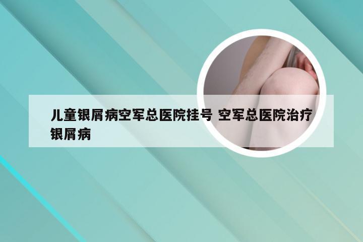 儿童银屑病空军总医院挂号 空军总医院治疗银屑病