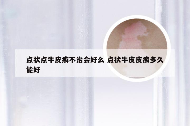 点状点牛皮癣不治会好么 点状牛皮皮癣多久能好