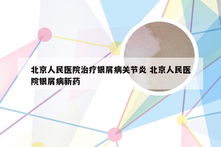 北京人民医院治疗银屑病关节炎 北京人民医院银屑病新药