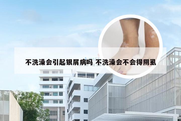 不洗澡会引起银屑病吗 不洗澡会不会得阴虱