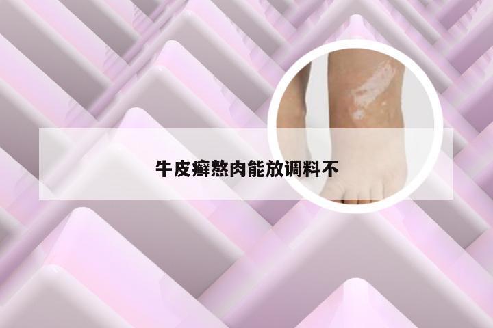 牛皮癣熬肉能放调料不