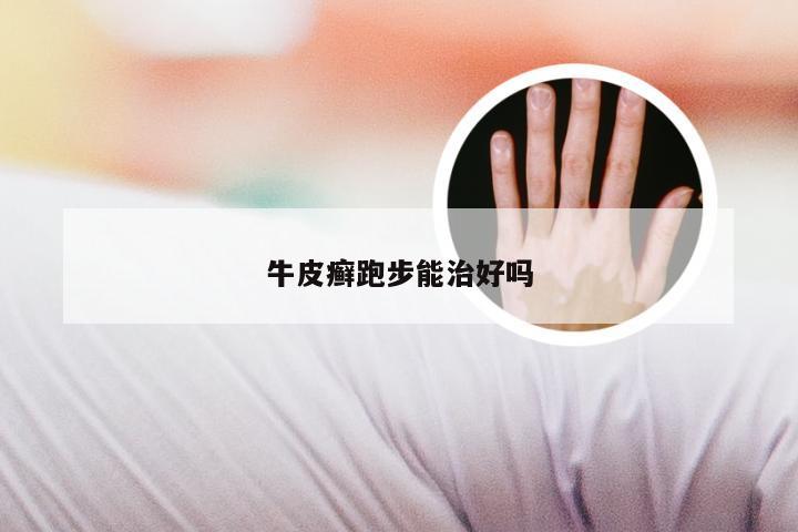 牛皮癣跑步能治好吗