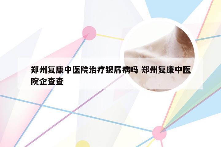 郑州复康中医院治疗银屑病吗 郑州复康中医院企查查