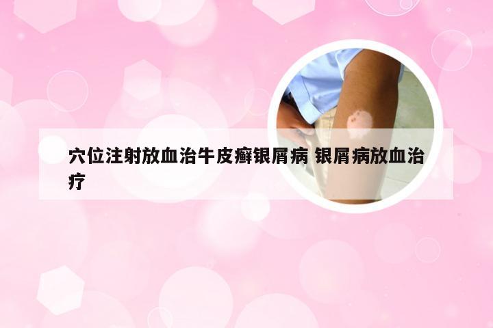 穴位注射放血治牛皮癣银屑病 银屑病放血治疗