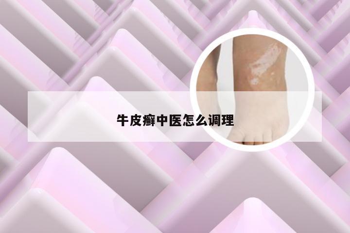 牛皮癣中医怎么调理