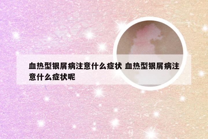 血热型银屑病注意什么症状 血热型银屑病注意什么症状呢