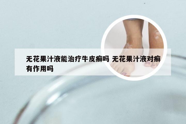 无花果汁液能治疗牛皮癣吗 无花果汁液对癣有作用吗