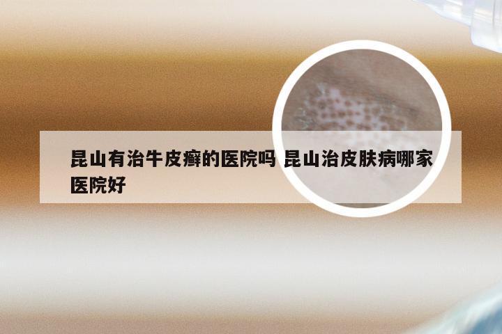 昆山有治牛皮癣的医院吗 昆山治皮肤病哪家医院好