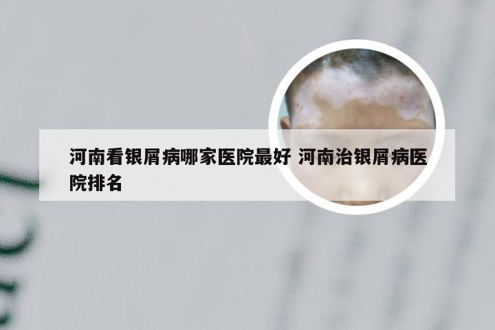 河南看银屑病哪家医院最好 河南治银屑病医院排名
