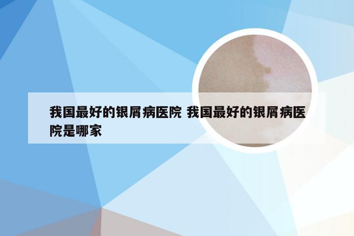 我国最好的银屑病医院 我国最好的银屑病医院是哪家